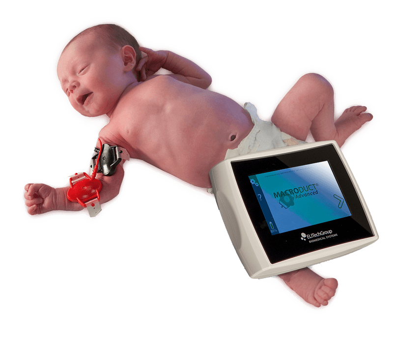 Macroduct Advanced Sweat Testing System